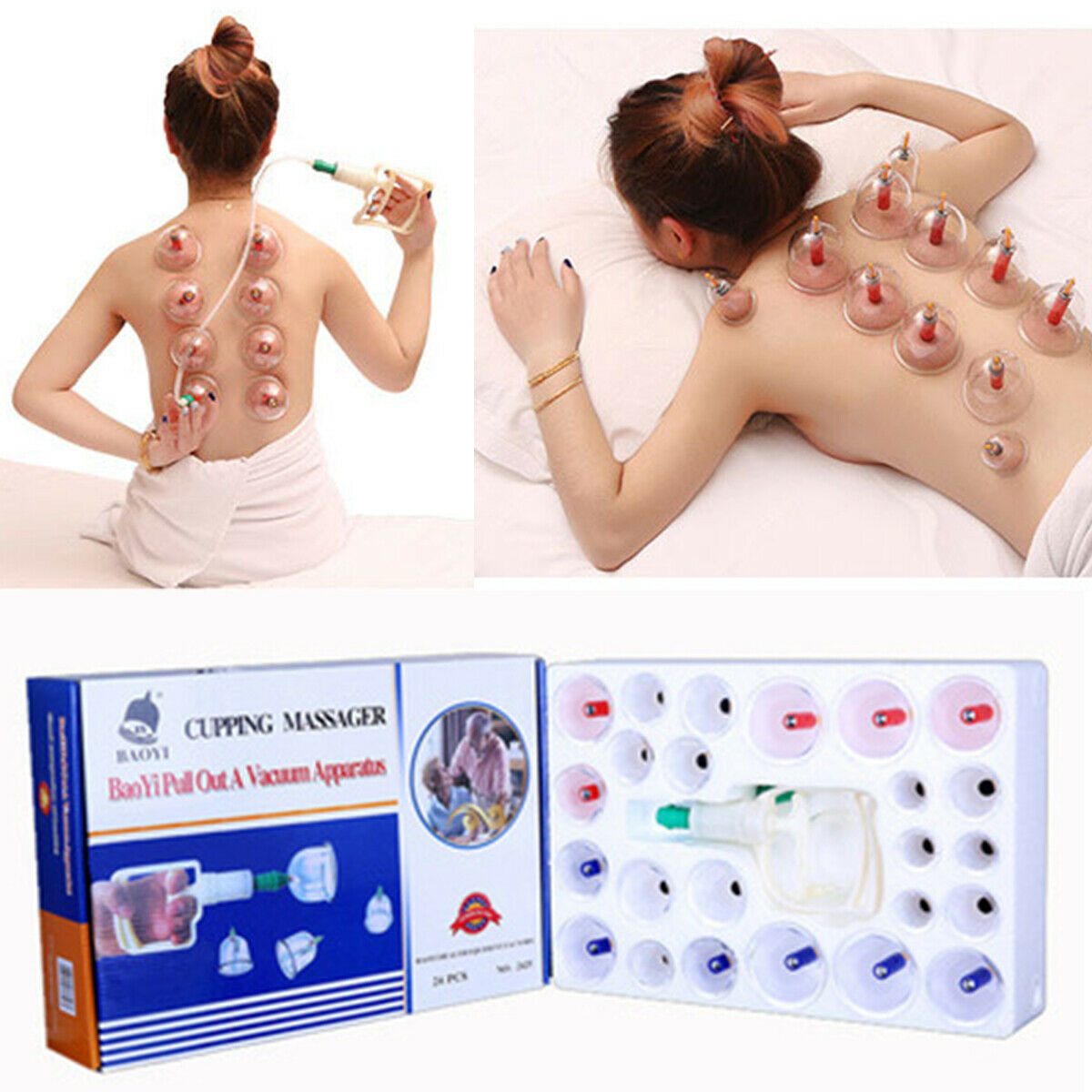 Vacuum Cupping Set Massage Kit Acupuncture Suction Massager Pain Relief